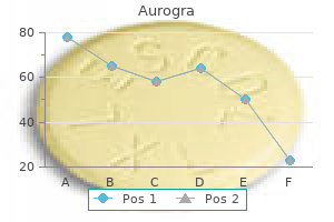 discount aurogra 100mg visa