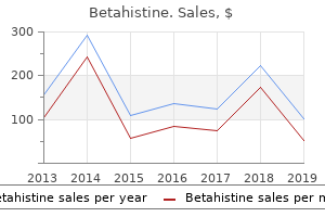 buy betahistine 16 mg on line