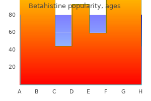 discount betahistine 16 mg mastercard