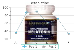 generic 16 mg betahistine