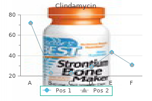 150mg clindamycin visa