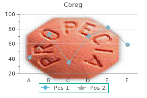 discount 25mg coreg fast delivery