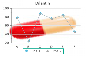 buy generic dilantin 100 mg on line