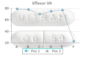 discount 150 mg effexor xr mastercard