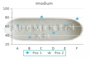 purchase 2 mg imodium mastercard