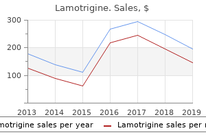 buy 100 mg lamotrigine with mastercard