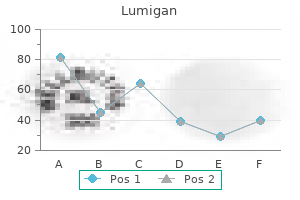 buy lumigan 3ml with mastercard