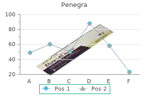 buy penegra 50mg line