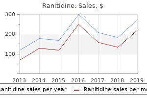 generic 300mg ranitidine fast delivery