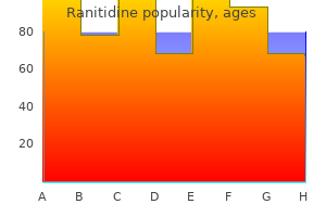 purchase 300mg ranitidine mastercard