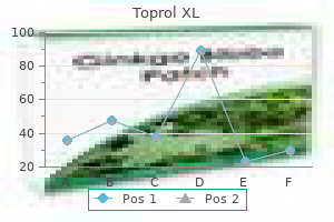 discount toprol xl 25mg with mastercard