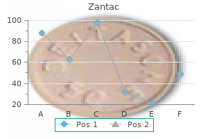 generic 300mg zantac mastercard